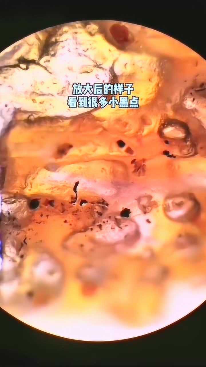 显微镜下的辣条放大1000倍后您看到了什么