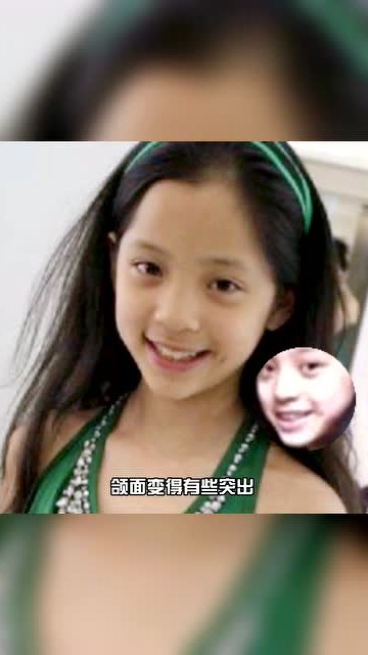 欧阳娜娜戴牙套真是个正确的选择长大后更美了