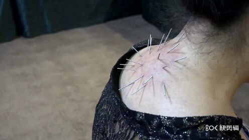 解晓丽老师:富贵包针法实操