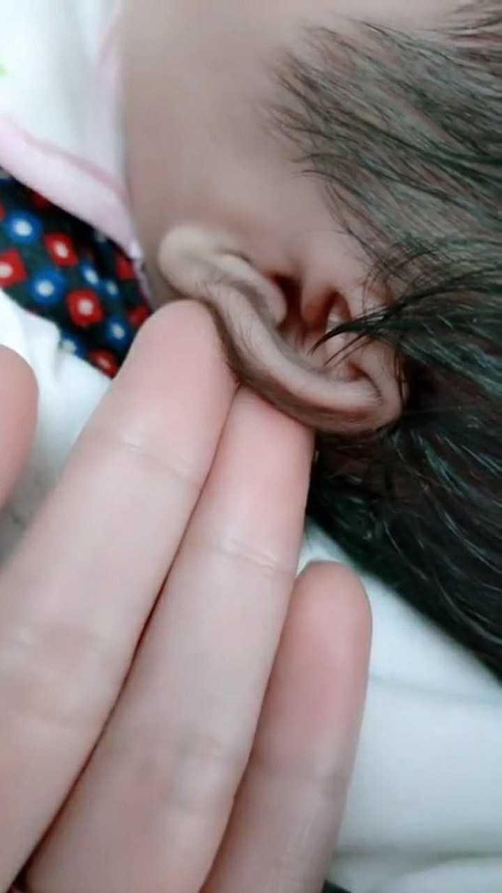 耳朵长毛 腾讯网