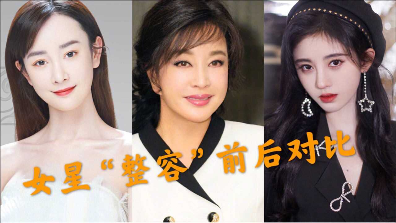女星"整容"前后对比,张檬取出假体重回颜值巅峰,刘晓庆拉皮扯到变形