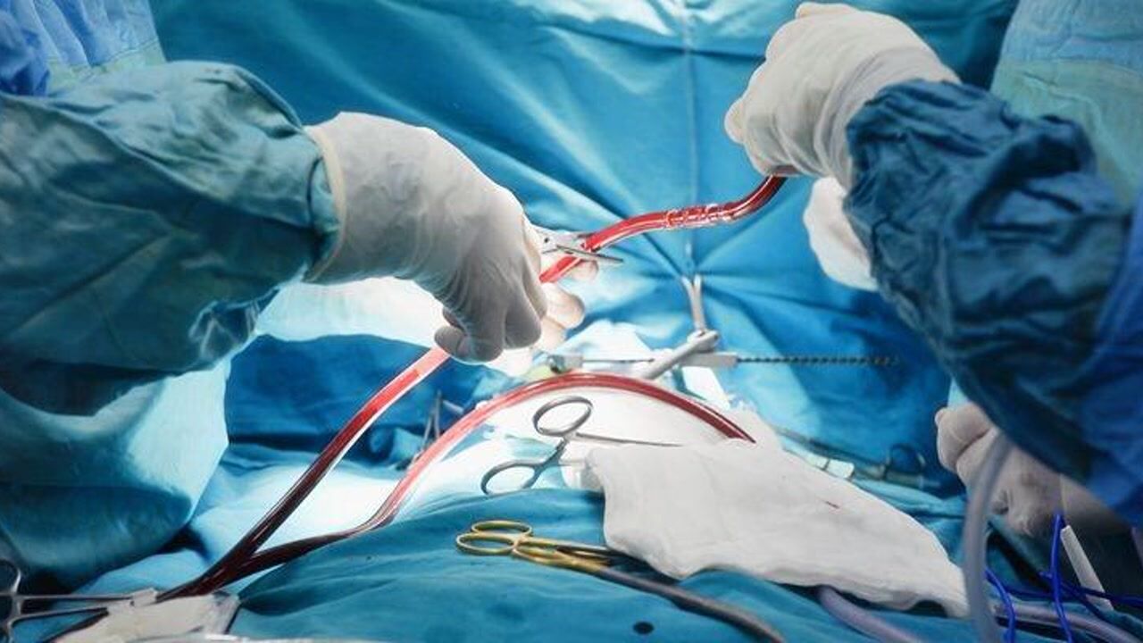 心脏搭桥手术流程图解图片