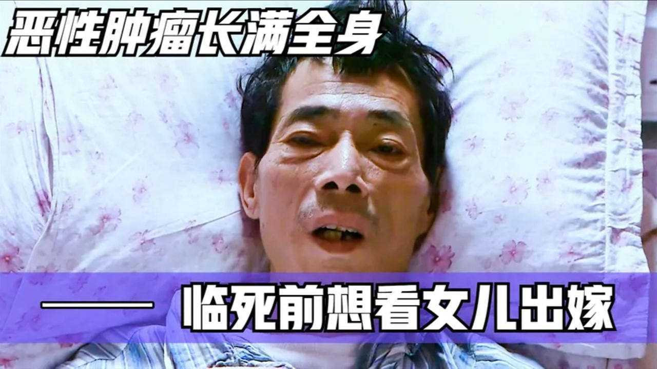 父亲患恶性肿瘤扩散全身,临死前说出最后的愿望,让人瞬间泪崩