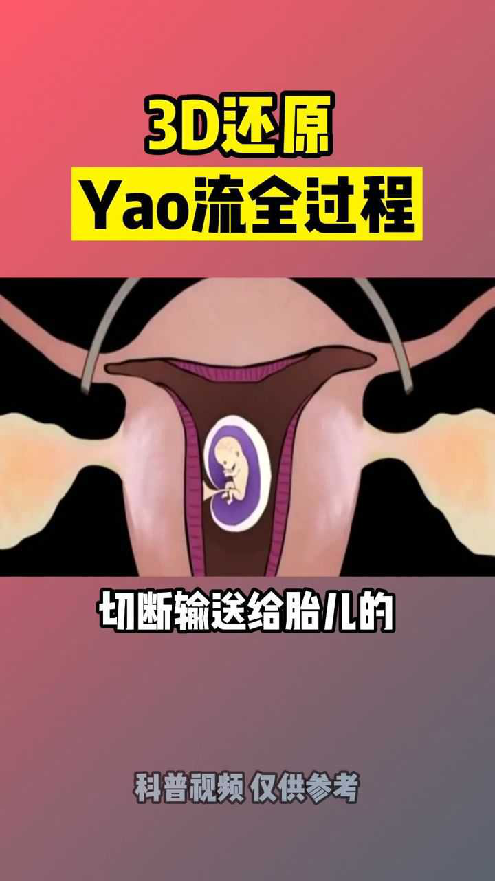 3d还原药流全过程_腾讯视频