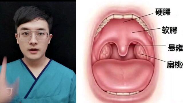 医学博士:教你怎么看上腭,判断有没有食管癌风险!