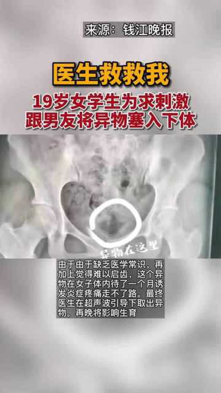 19岁女学生为求刺激，跟男友将异物塞入下体，异物在体内呆了一个月_腾讯视频