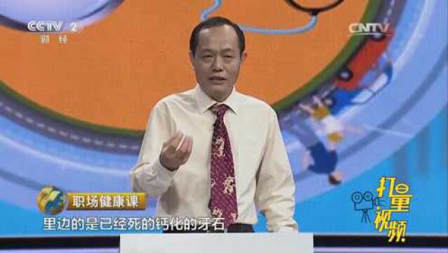 牙结石是什么,都有哪些危害?来听听专家怎么说