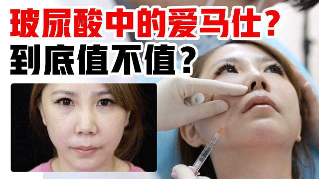 鼻唇沟有救了?乔雅登雅致硬核实测!玻尿酸中的“爱马仕”凭啥这么贵?