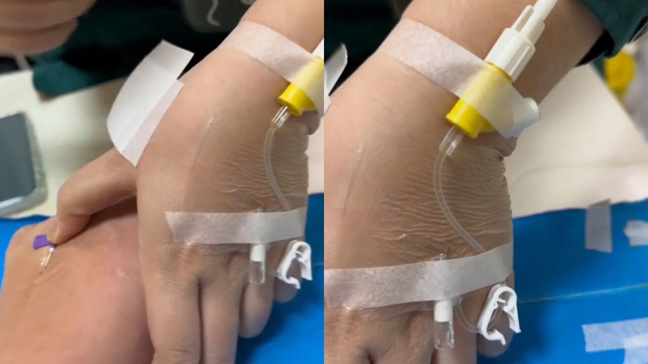 男子到医院输液 发现扎针护士手上也在输液 拍下画面直说"心疼"