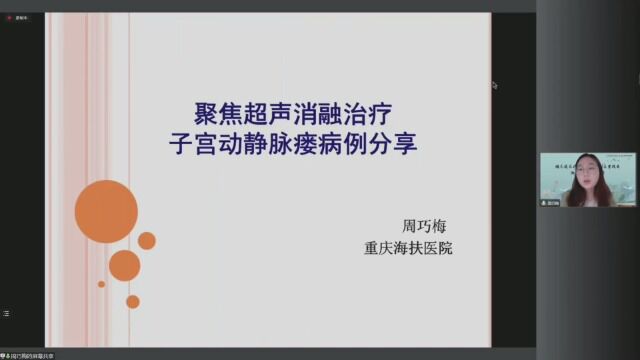 聚焦超声消融治疗子宫动静脉瘘病例分享