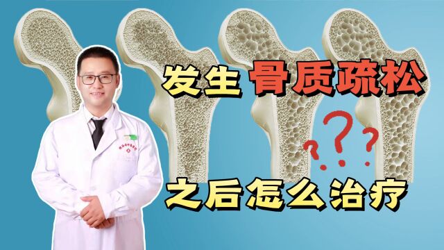 发生骨质疏松之后,怎么治疗?