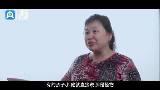 全国“爱耳日”丨中国医学科学院整形外科医院联合海报新闻面向全国征集小耳畸形患者