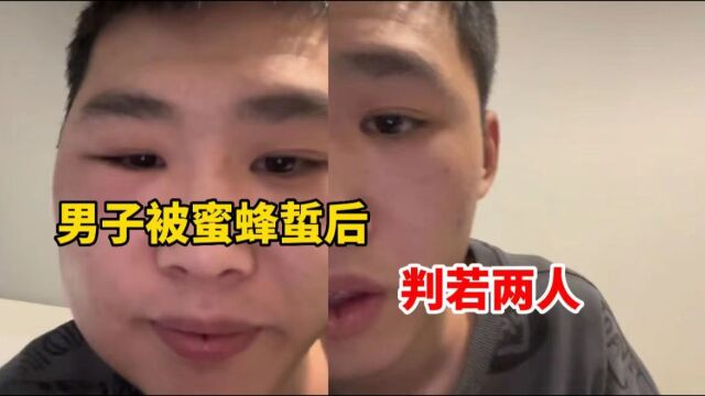 判若两人!男子被蜜蜂蜇后,右边脸肿成“表情包”