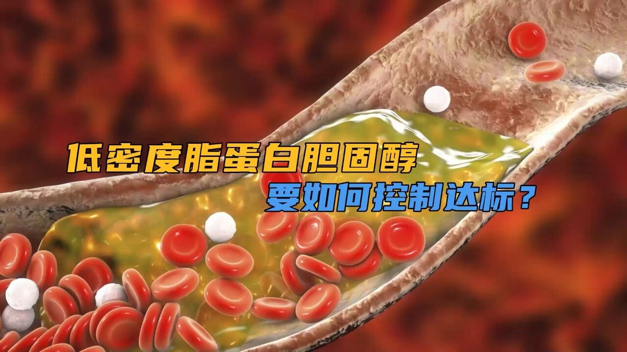 低密度脂蛋白胆固醇,要如何控制达标?