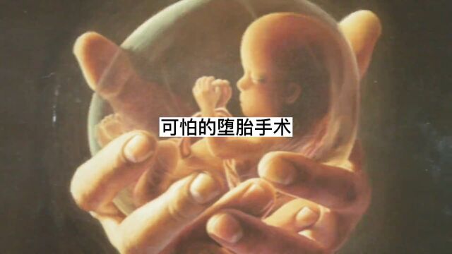 堕胎手术究竟有多恐怖?#科普 #引产之痛 #涨知识