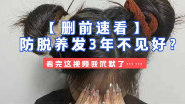 防脱育发竟如此简单?过来人教你如何低成本生发!简单到哭!