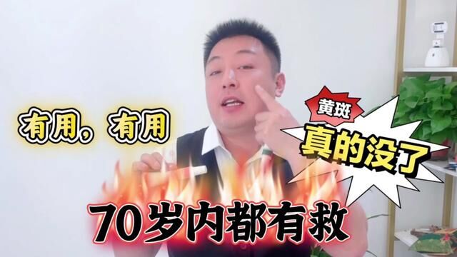 无论你脸上的“黄斑”有多深,试试这个老国货,70岁以内都有救