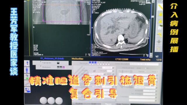 精准胆道穿刺引流退黄复合引导