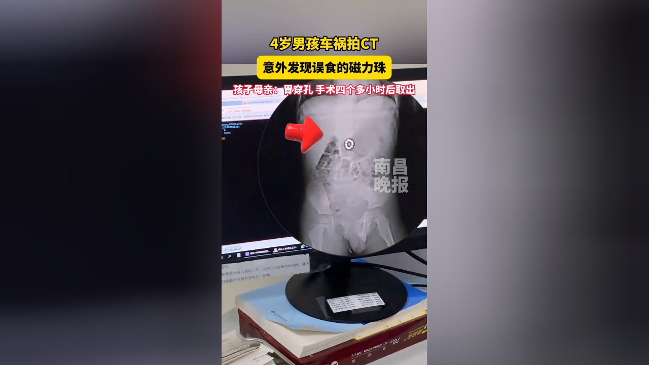 小孩误吞磁力珠大约多长时间可以拉出来 小孩误吞磁力珠约莫
多长时间可以拉出来（小孩误吞磁力珠大约多长时间可以拉出来） 磁力珠