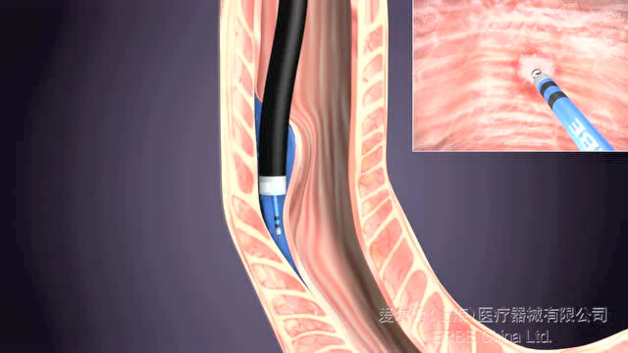 poem手术_高清1080P在线观看平台_腾讯视频