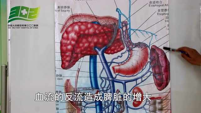 什么是门静脉高压_腾讯视频