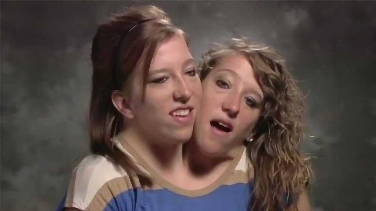 美国连体"双头人"姐妹,各自拥有一个男朋友!_腾讯视频