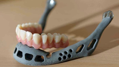 国际首例  3D打印“下颌骨”植入10岁儿童面部