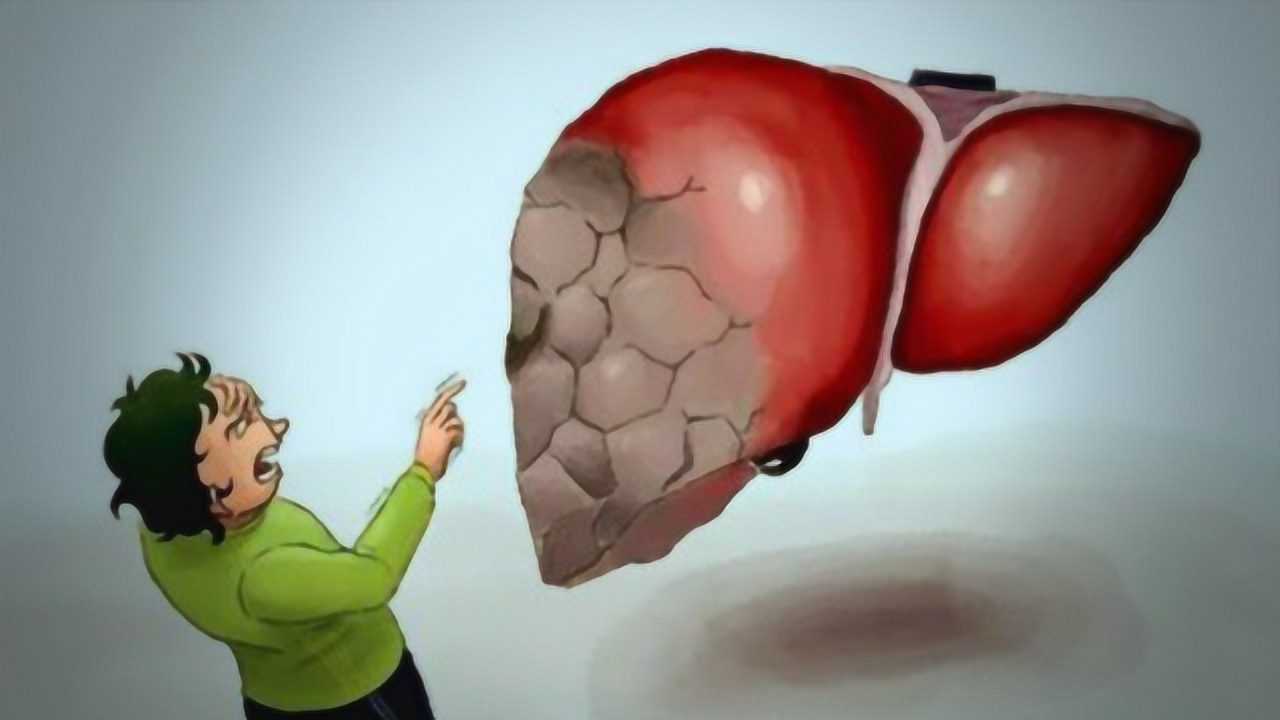 脂肪肝是如何发展成肝硬化的?_腾讯视频
