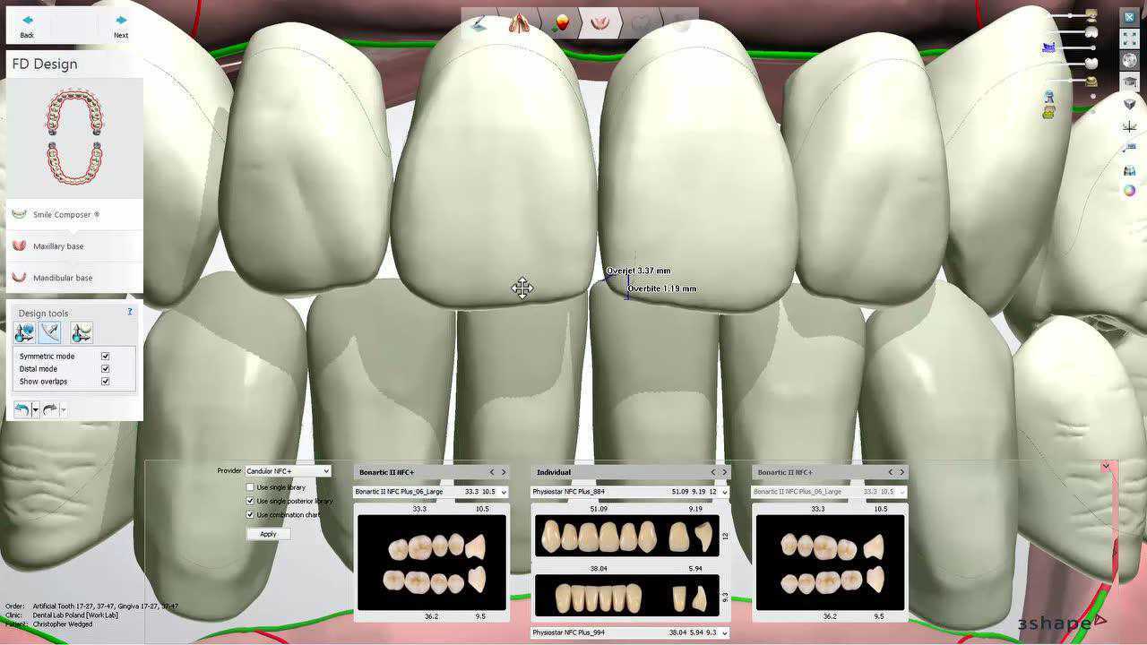 3shapeds软件全口义齿设计