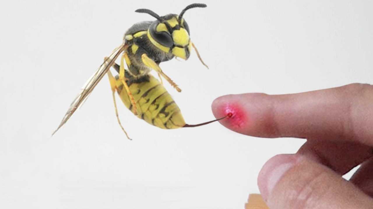 被杀人蜂蜇一下后果有多严重老外作死不听劝结果尴尬了