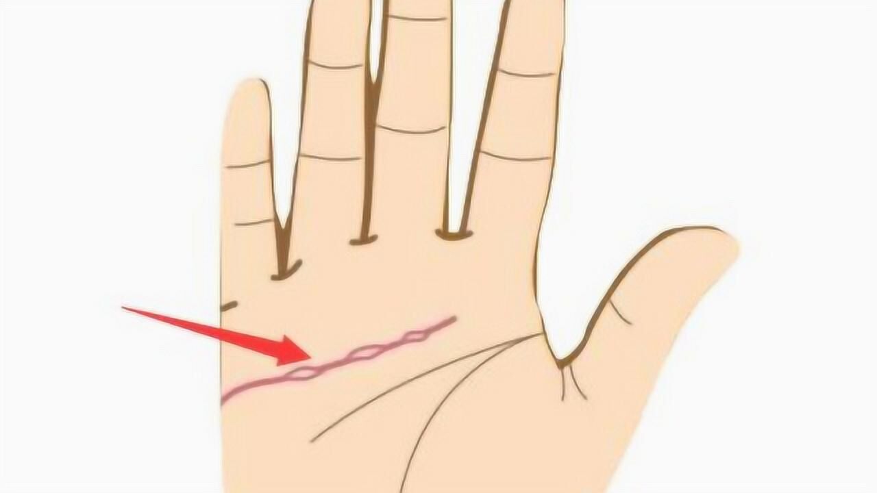 "岛纹"究竟代表什么?手上这些地方有岛纹一定要留意!