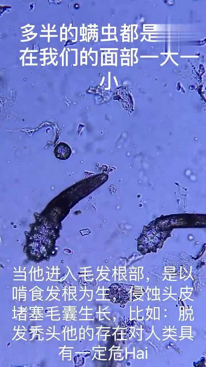 把螨虫在显微镜下放大看到它的真正样貌真是开眼了