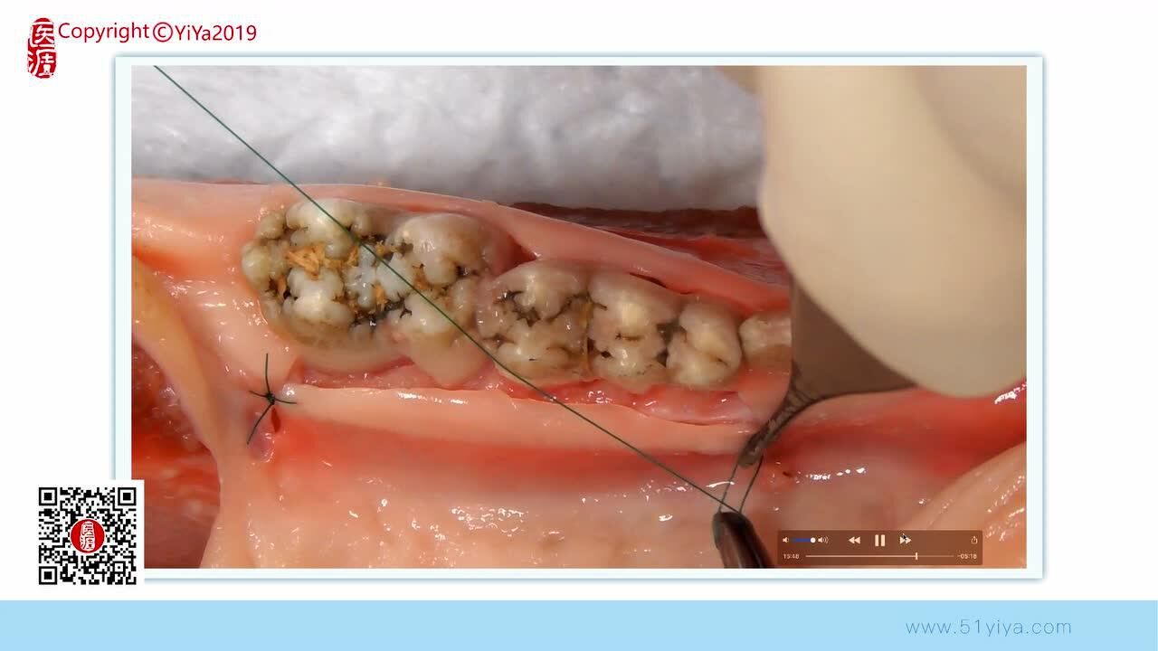 ipoi牙周高级专科医生认证课程龈膜手术猪下颌骨实操3