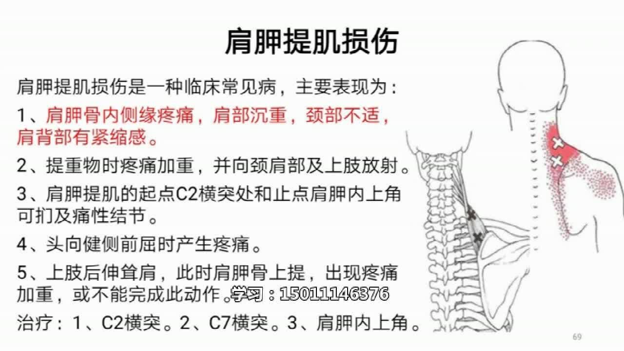 叶颖华肌筋膜松懈术之肩胛提肌_高清1080P在线观看平台_腾讯视频