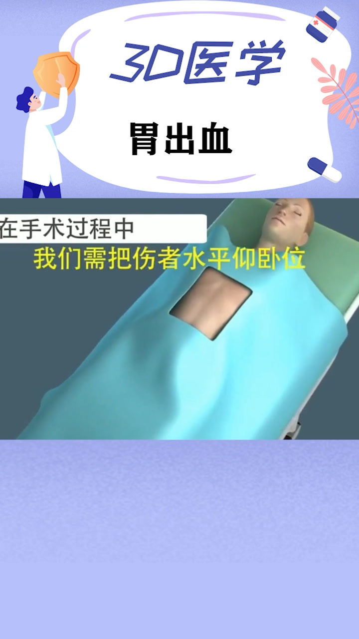 胃出血手术过程:要开这么多刀