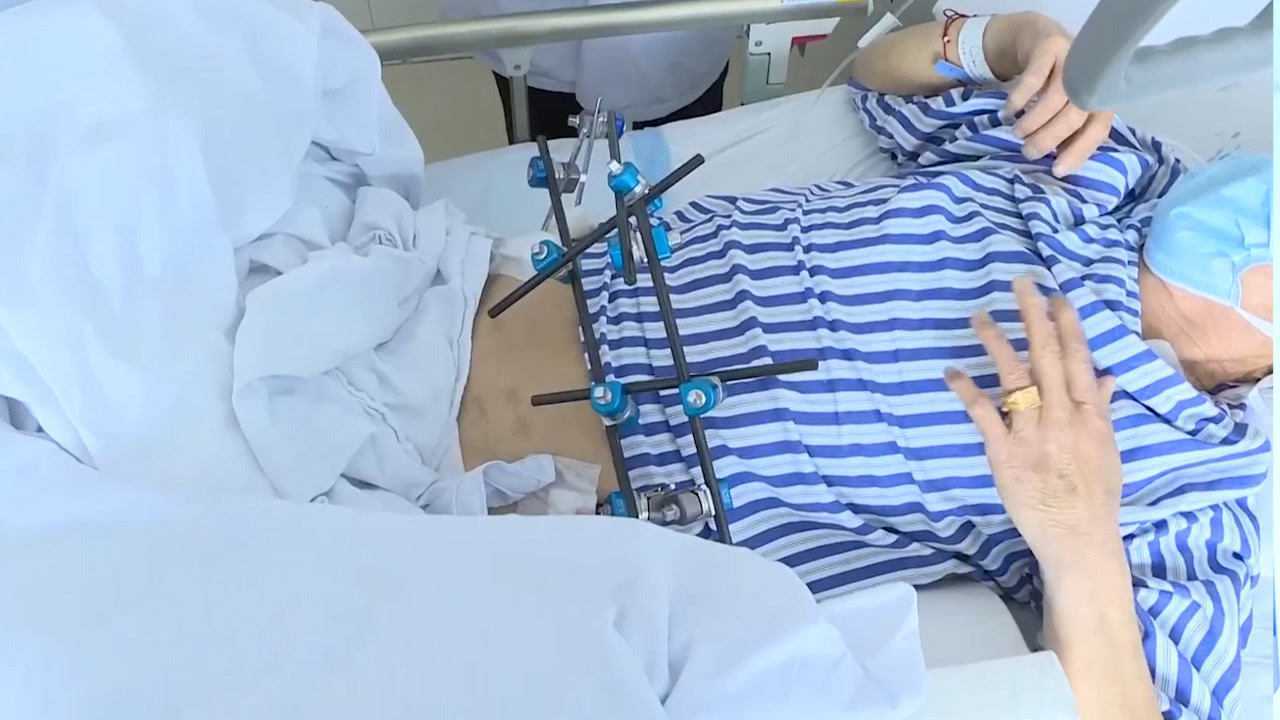 奇迹生还!男子被货车撞飞全身20多处骨折:体内血液基本换了一遍