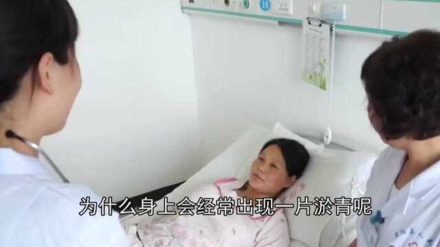 为何身上总是无故出现淤青,尤其是女性看完令人心酸不已