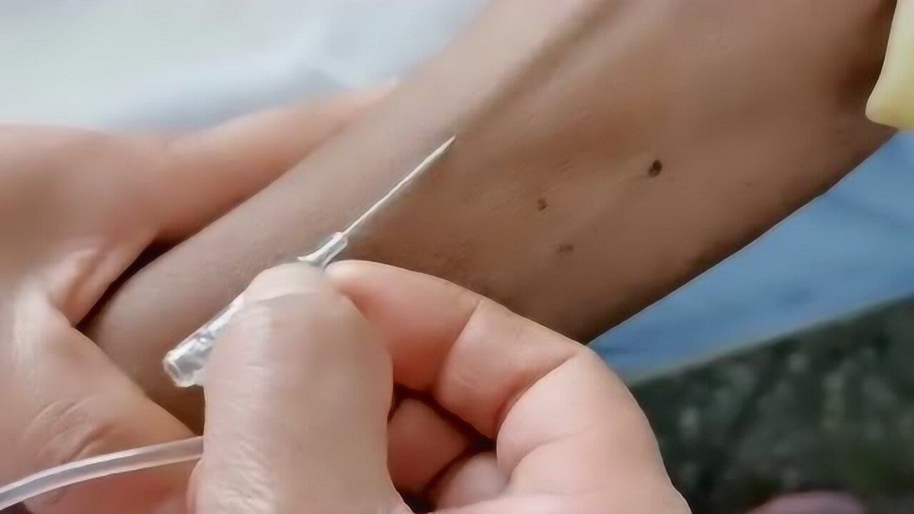 护士的单手留置针操作看到这么大的针头我胳膊莫名的疼了一下