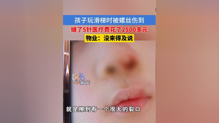 孩子玩游乐设施,鼻子被突出的螺丝划伤,缝了5针,物业:已经报给保险