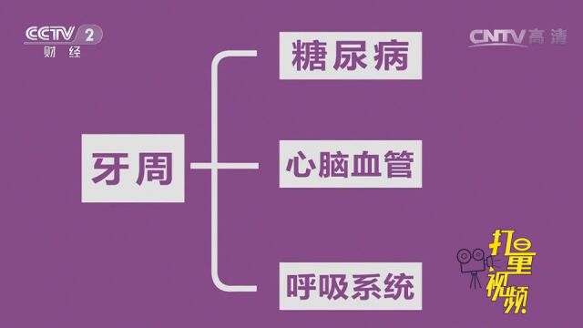 牙周炎竟如此可怕!口臭只是早期,晚期可致死