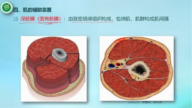 肌的辅助结构 深筋膜