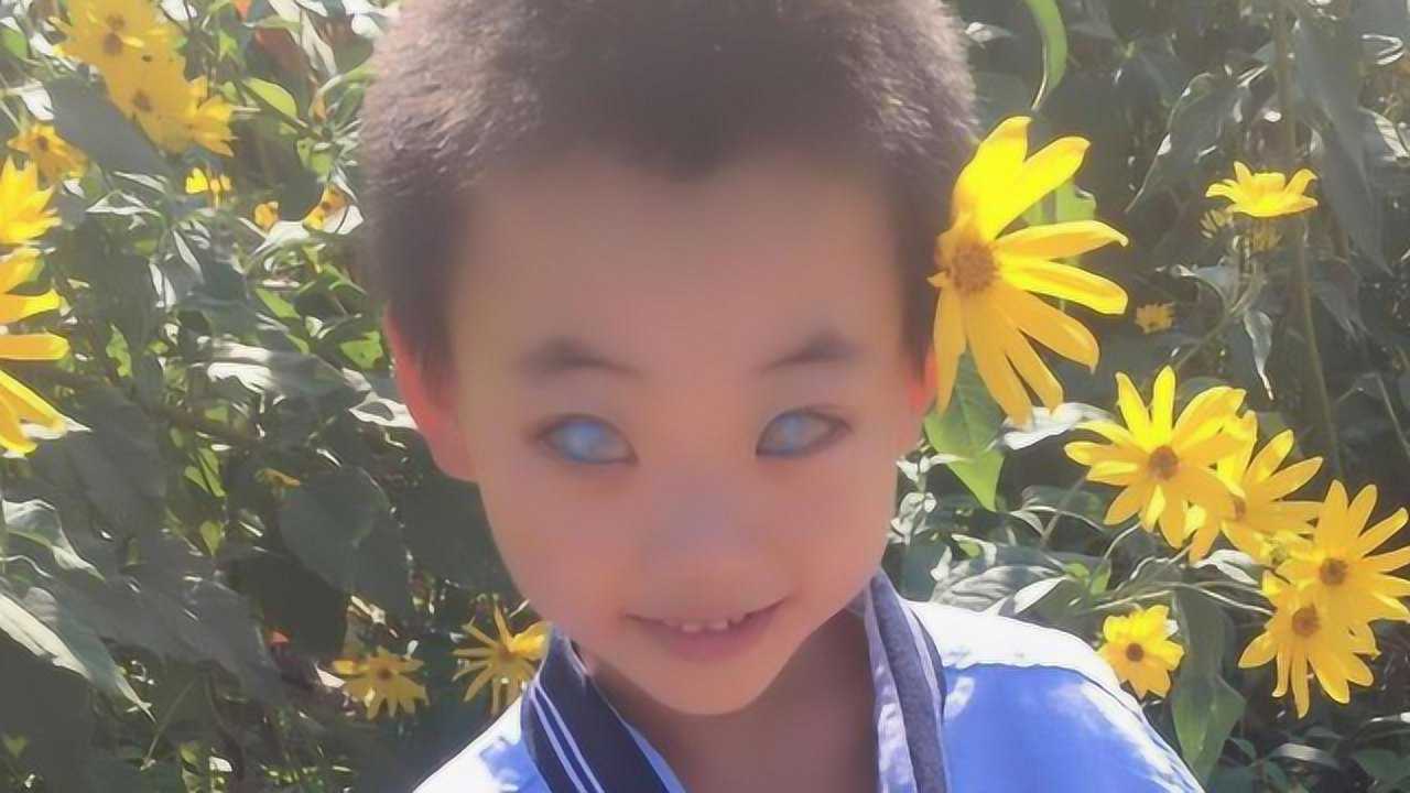 小男孩眼睛被眼白覆盖被人称为鬼眼从小被抛弃未尝过父爱
