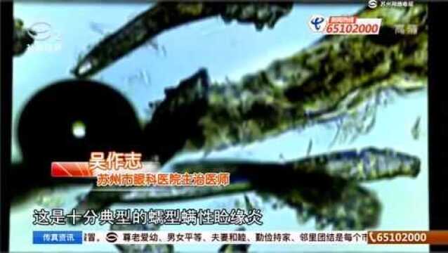 一根睫毛爬满11只螨虫 干燥冬季警惕“干眼症”