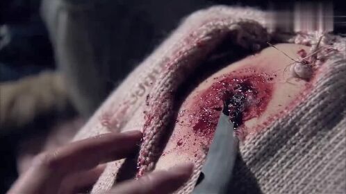 猎魔:美女中弹,小伙亲自拿刀,竟给美女做手术!