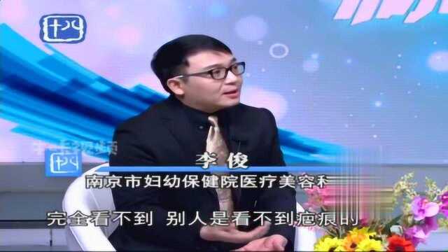 产后健康:做腹壁成形术会留疤痕吗?如何能不影响美观?