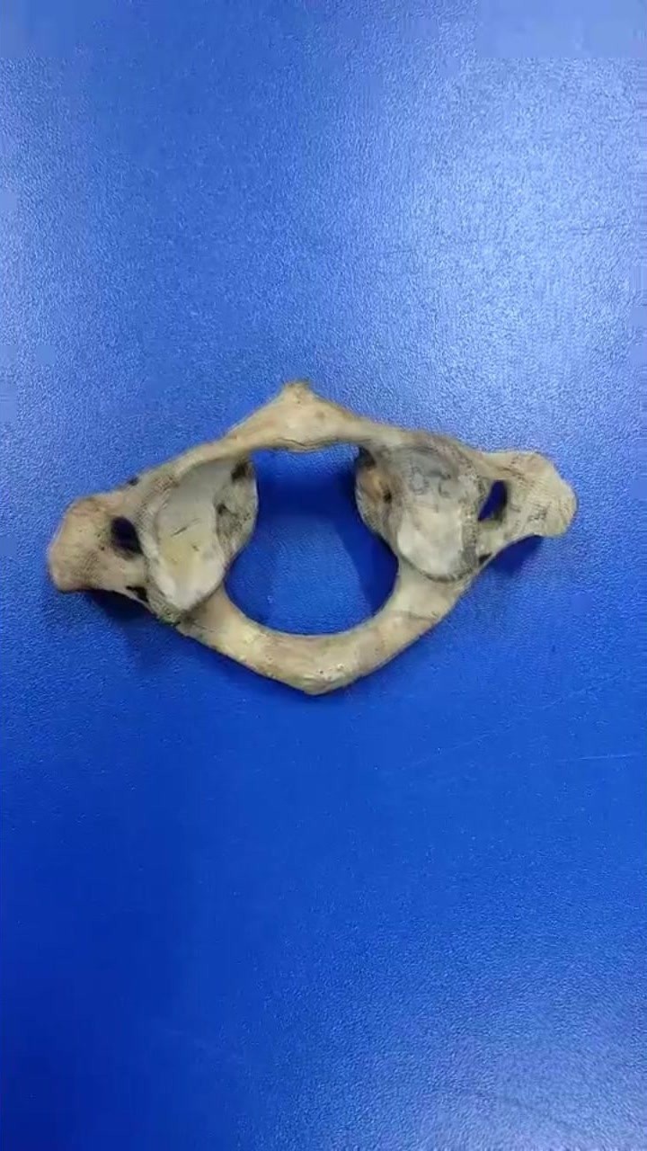 寰椎上面的解剖