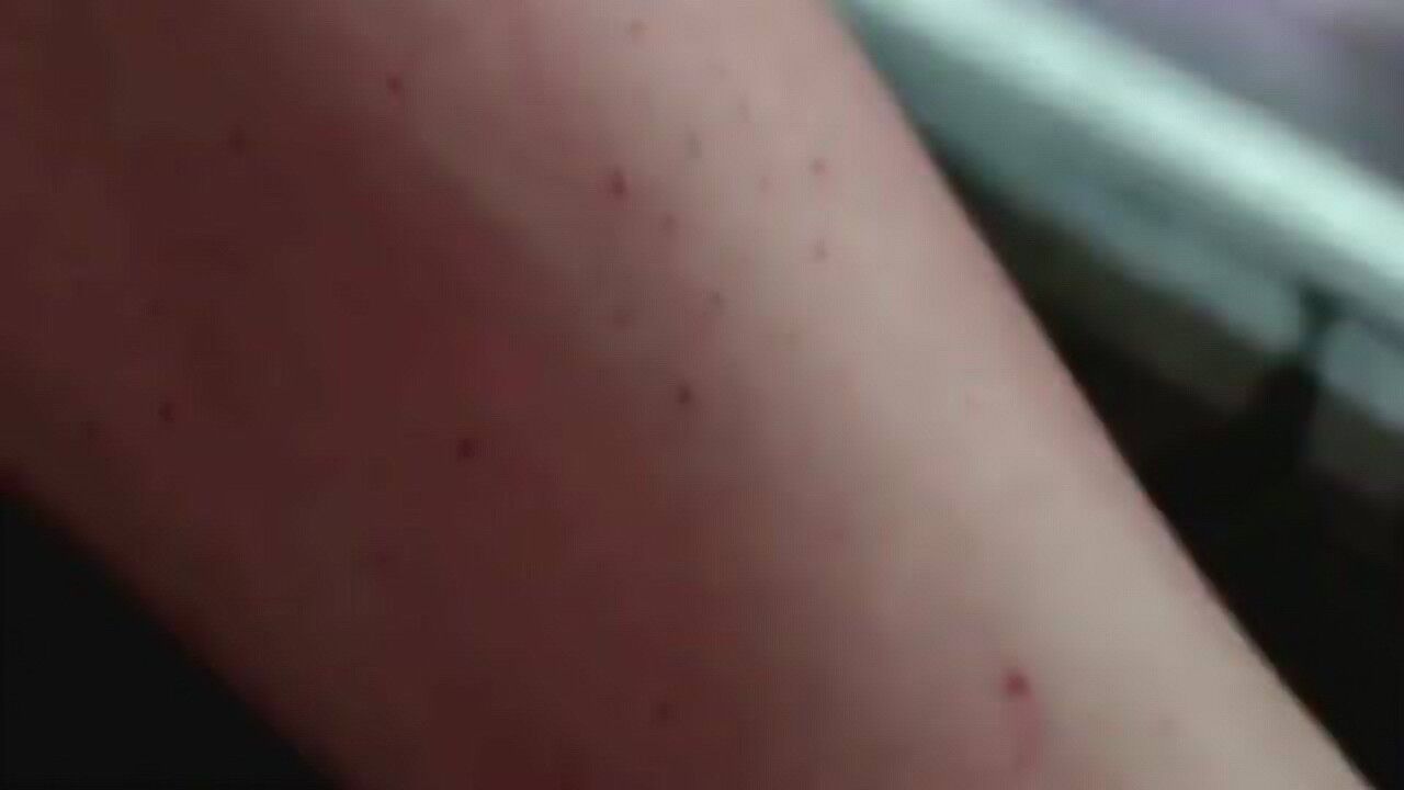 反派带着毒药针管,大哥不小心被她针头扎到手,顿时就慌神了!