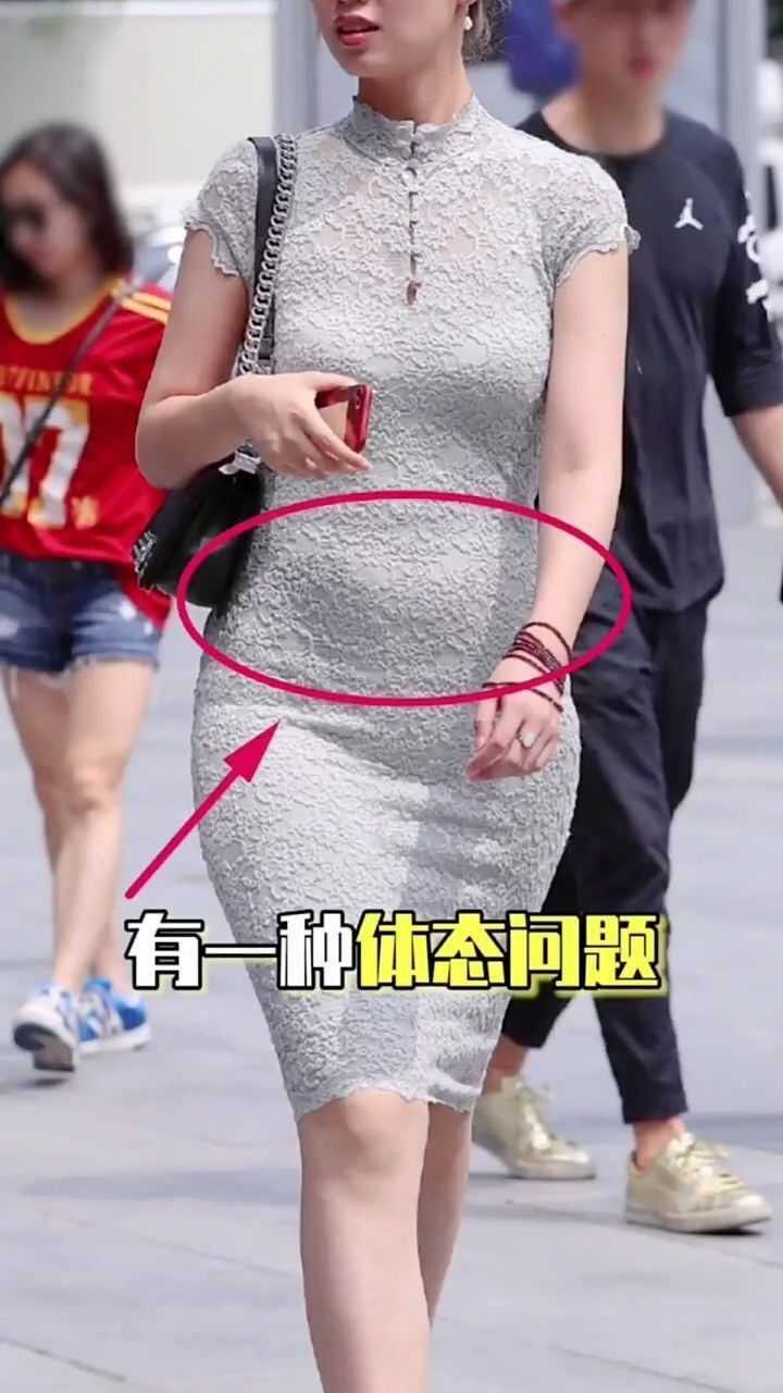 小肚子突出很头疼,很有可能是骨盆前倾导致的