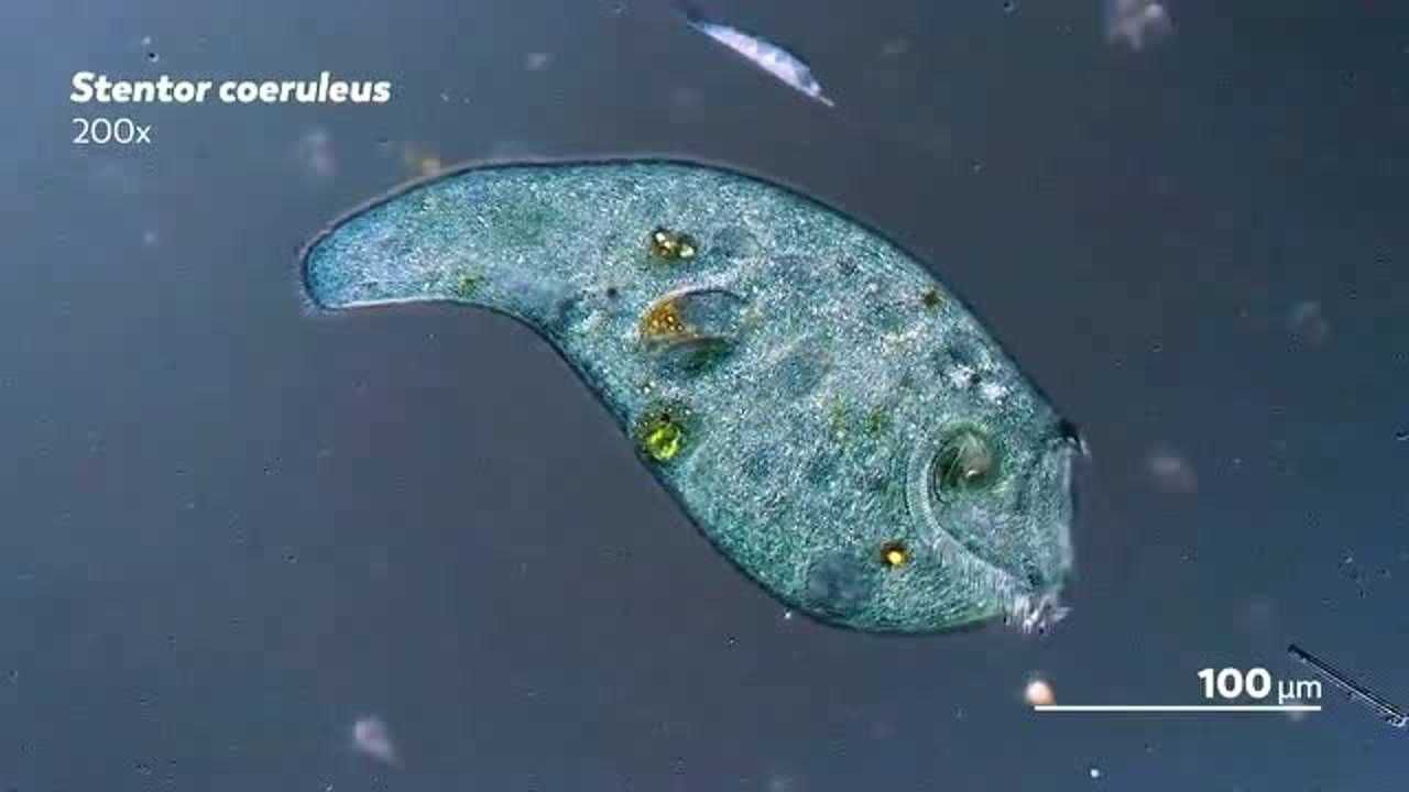 显微镜下的天蓝喇叭虫它们的纤毛十分突出几乎感觉能触手可摸