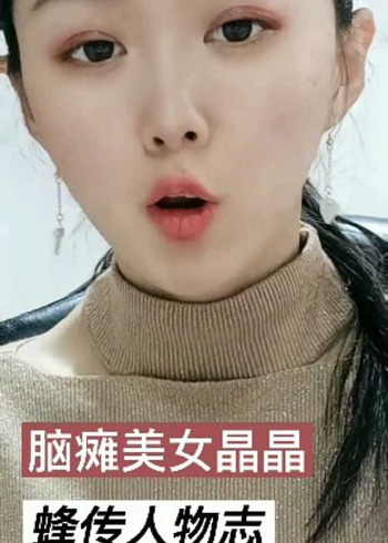 脑瘫美女晶晶,上天遗忘在人间的精灵